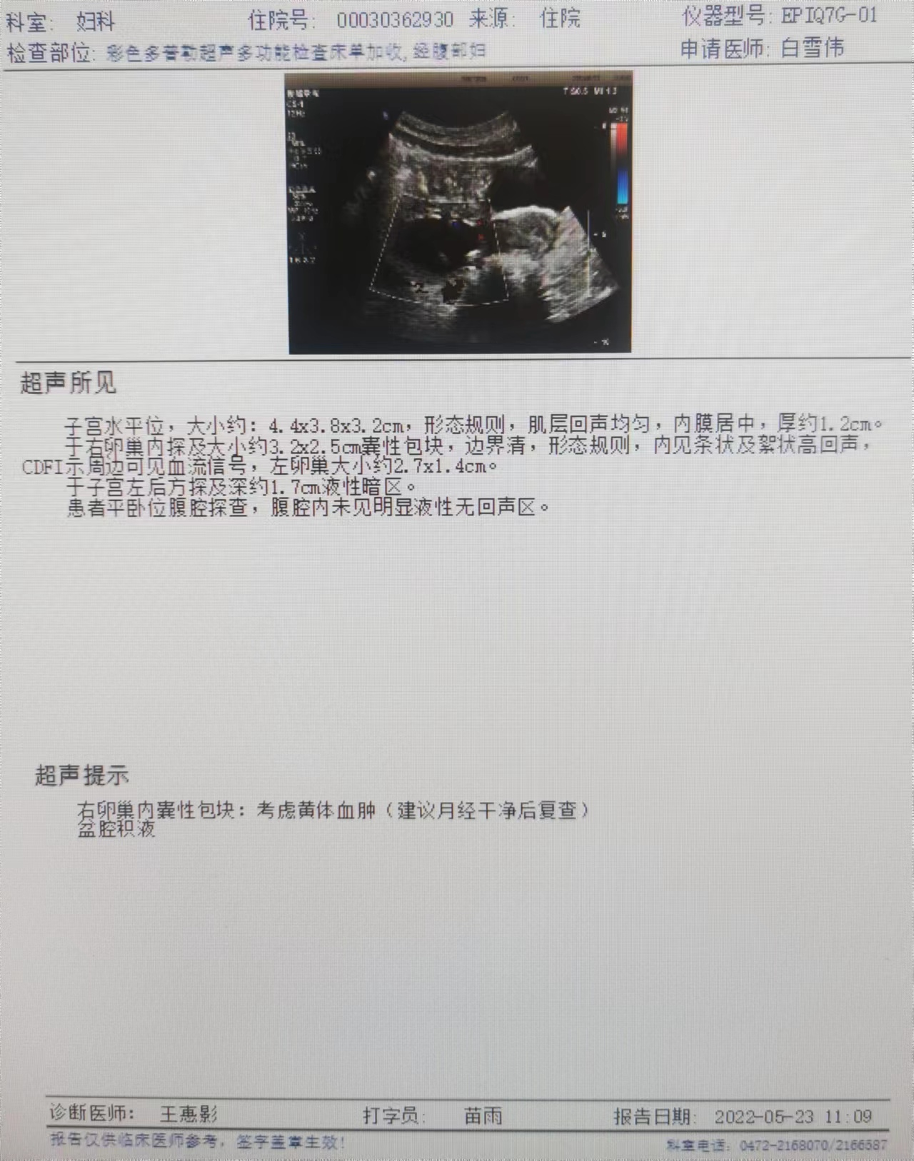 一例卵巢黄体囊肿破裂的诊疗体会